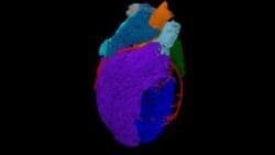 This is a 3D image of the heart.